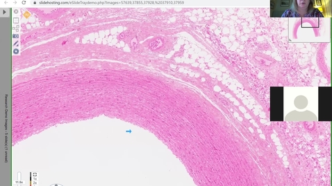 Thumbnail for entry 201201-M1-8am-FD-Normal Histology of Tubular Organs: GI Tract and Blood Vessels-Colello