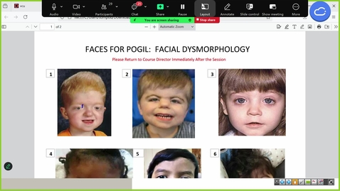 Thumbnail for 250827 - M1 - 10AM - MBHD - Pathogenesis of Genetic Disease I