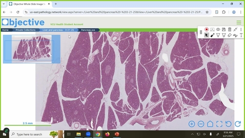 Thumbnail for 250321  - M1 - GI - 10am - Inflammatory Bowel Disease - Patel