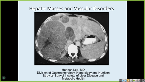 Thumbnail for 250326  - M1 - GI - 8am - Liver Masses and Vascular Disorders + Pancreatitis/Pancreas as Masses -  Lee + Patel