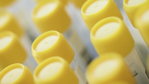 Thumbnail for Ver mas allá: Una mirada compartida a la uveítis. Tue Mar 24 2026