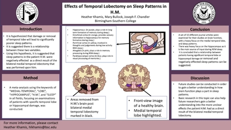 Thumbnail for Effects of Temporal Lobectomy on Sleep Patterns in H.M.