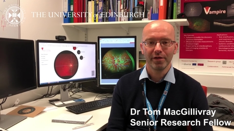 Thumbnail for entry Dr Tom MacGillivray - Research in a nutshell
