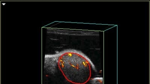 Thumbnail for EPI Ultrasound of mouse testis
