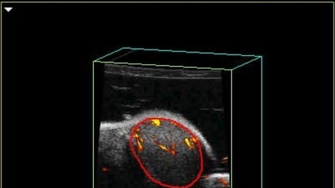 Thumbnail for entry EPI Ultrasound of mouse testis