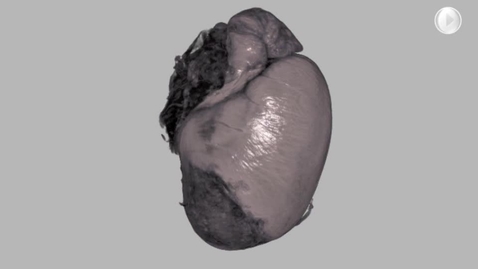 Thumbnail for Shortened OPT movie