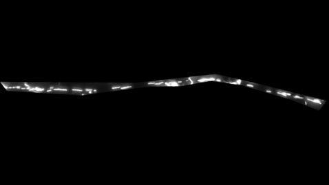 Thumbnail for Film 2 - a damaged motor neuron with the C9orf72 gene after boosting the mitochondria - time lapse