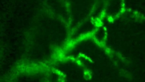 Thumbnail for Neuromuscular junction endomicroscopy