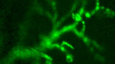 Thumbnail for entry Neuromuscular junction endomicroscopy