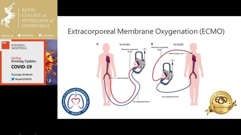 Thumbnail for entry COVID-19- A View from the Scottish Critical Care Frontline Webinar (March 2020)