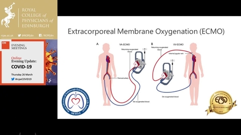 Thumbnail for COVID-19- A View from the Scottish Critical Care Frontline Webinar (March 2020)