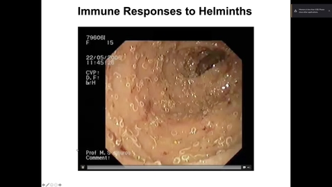 Thumbnail for Imm3_Helminths_pt1_intro