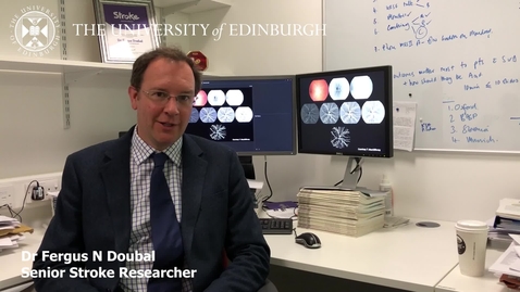 Thumbnail for entry Dr Fergus Doubal - Research in a nutshell