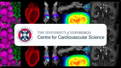 Thumbnail for CVS PhD Video - 2020 Ioannis Stasinopoulos