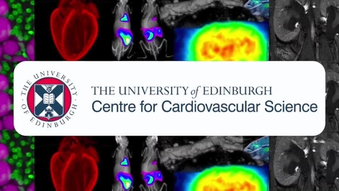 Thumbnail for entry CVS PhD Video - 2020 Katherine Kentistou