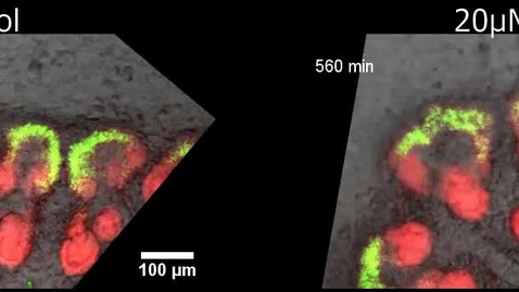 Thumbnail for Effect of PI3K signalling on nephron progenitor cells