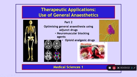 Thumbnail for entry Medical Sciences 1: Therapeutic Applications: Use of General Anaesthetics Part 2 Dr Phil Larkman