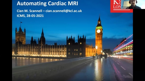 Thumbnail for 28 May 2021 Cian Scannell (King's College London) - Automating cardiac MRI