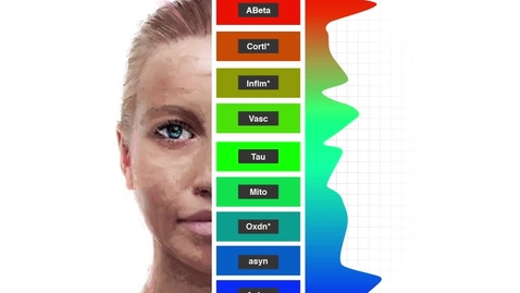 Thumbnail for entry Alzheimer's dementia / disease profiling sequence