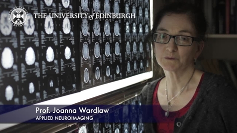 Thumbnail for Joanna Wardlaw- Applied Neuroimaging - Research In A Nutshell- Edinburgh Neuroscience-03/12/2012