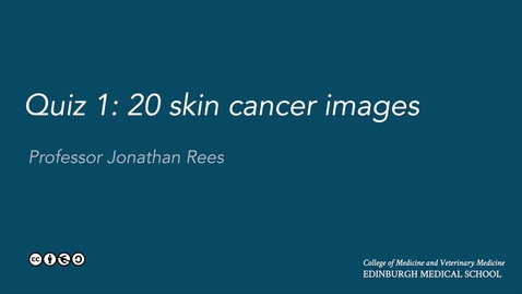 Thumbnail for entry Quiz 01: skin cancer