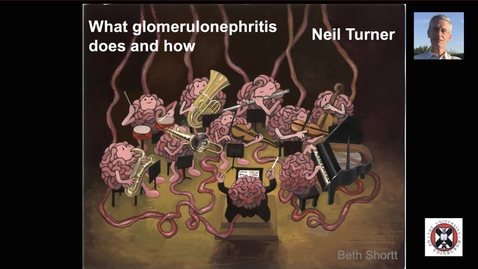 Thumbnail for entry Glomerulonephritis: what it does and how