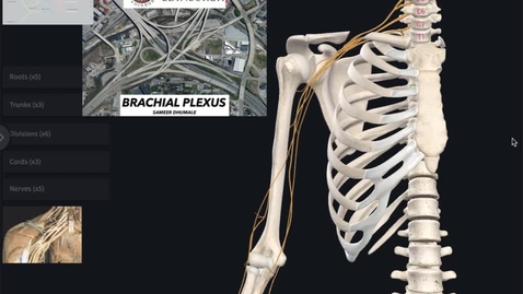 Thumbnail for entry Axilla - Brachial Plexus