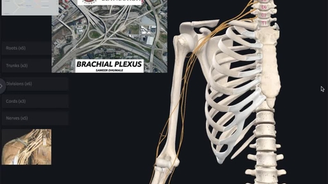 Thumbnail for Axilla - Brachial Plexus