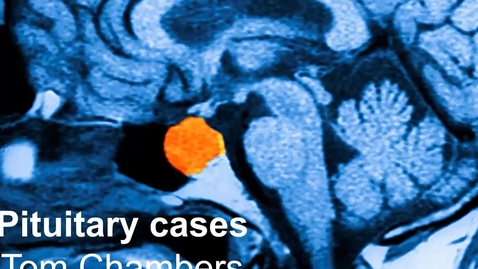 Thumbnail for entry Pituitary cases - Tom Chambers.mp4