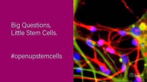 Thumbnail for entry #OpenUpStemCells: Are there stem cell treatments for MS in the UK?