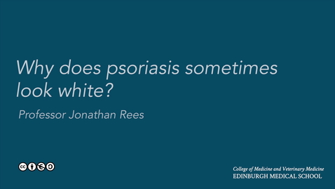 Thumbnail for Why does psoriasis sometimes look white?