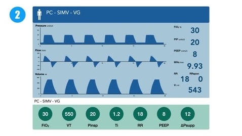 Thumbnail for Troubleshooting and Making Changes to Invasive Ventilation
