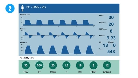 Thumbnail for entry Troubleshooting and Making Changes to Invasive Ventilation