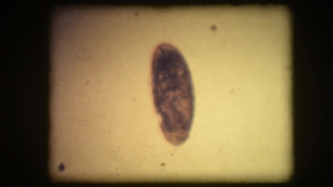 Thumbnail for Drosophila egg