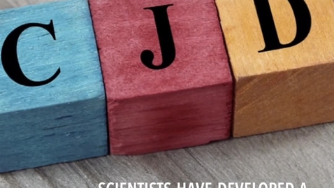 Thumbnail for CJD study brings fresh hope in quest for treatments