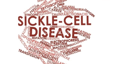 Thumbnail for entry Sickle cell disease