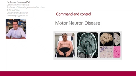 Thumbnail for Command and Control - Motor Neuron Disease