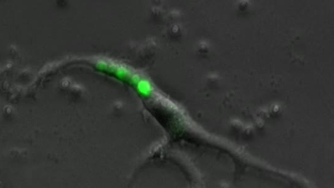 Thumbnail for Microglia cells in action