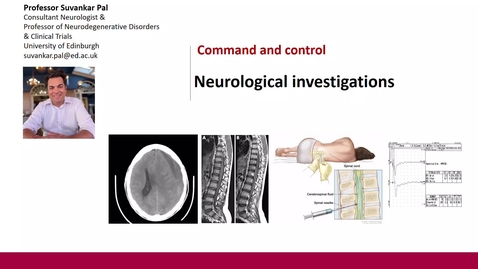 Thumbnail for Command &amp; control - Neurological investigations