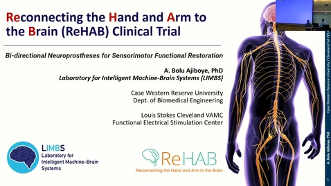 Thumbnail for A. Bolu Ajiboye - Reconnecting the Hand and Arm to the Brain (ReHab) Clinical Trial