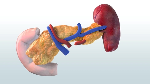 Thumbnail for Kidney Pancreas Transplantation