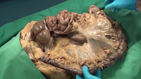 Thumbnail for Mesentery is a continuum