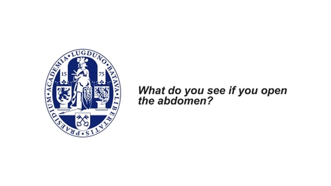 Thumbnail for MOOC 1.5 What do you see if you open the abdomen (in MOOC Anatomy of the Abdomen and Pelvis)