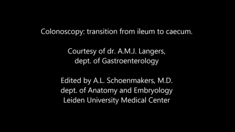 Thumbnail for Colonoscopy ileocaecal junction, Langers, Schoenmakers, LUMC (v4DEF)