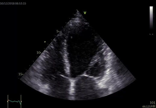 Kazuistiky z III. Cyklu - Nechme srdce bít_5_kazuistika_Video_1A_Dr_Hlubocka