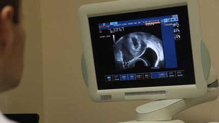 scanner screen