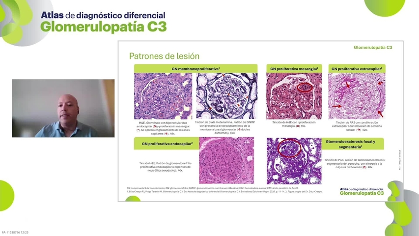 Renal_Fabhalta_Ficha1GC3AtlasGC3