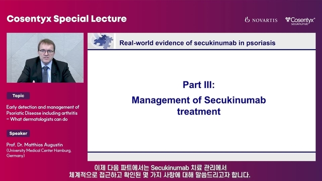 Part3 Management of Secukinumab treatment_Prof. Dr. Matthias Augustin