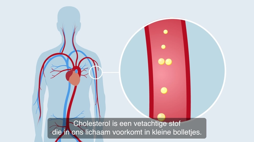 Hoog cholesterol