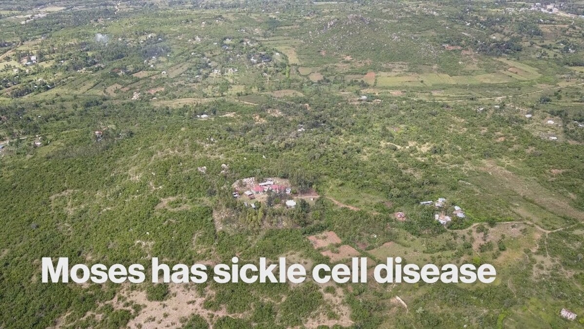 Moses has sickle cell disease